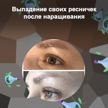 Как восстановить ресницы после выпадения